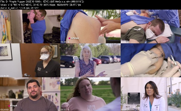 307136300_dr-pimple-popper-s08e10-1080p-hevc-x265-megusta.jpg